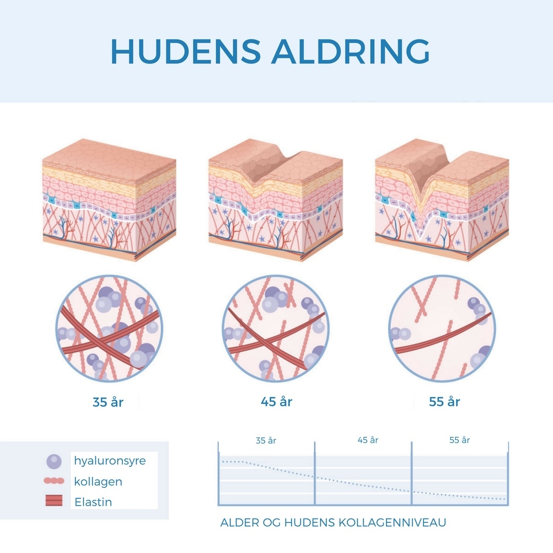 hudensaldring.jpeg