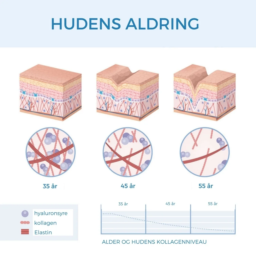 hudensaldring.jpeg