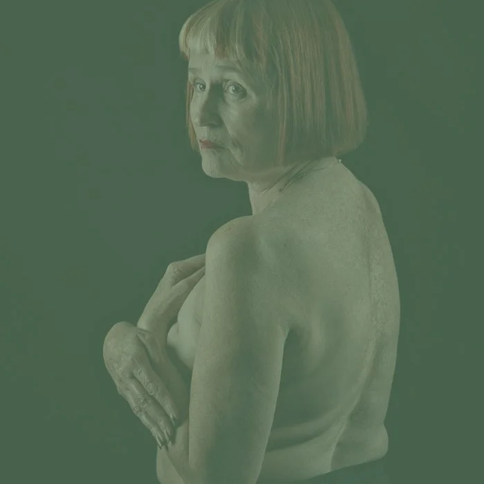 Women with secondary breast cancer