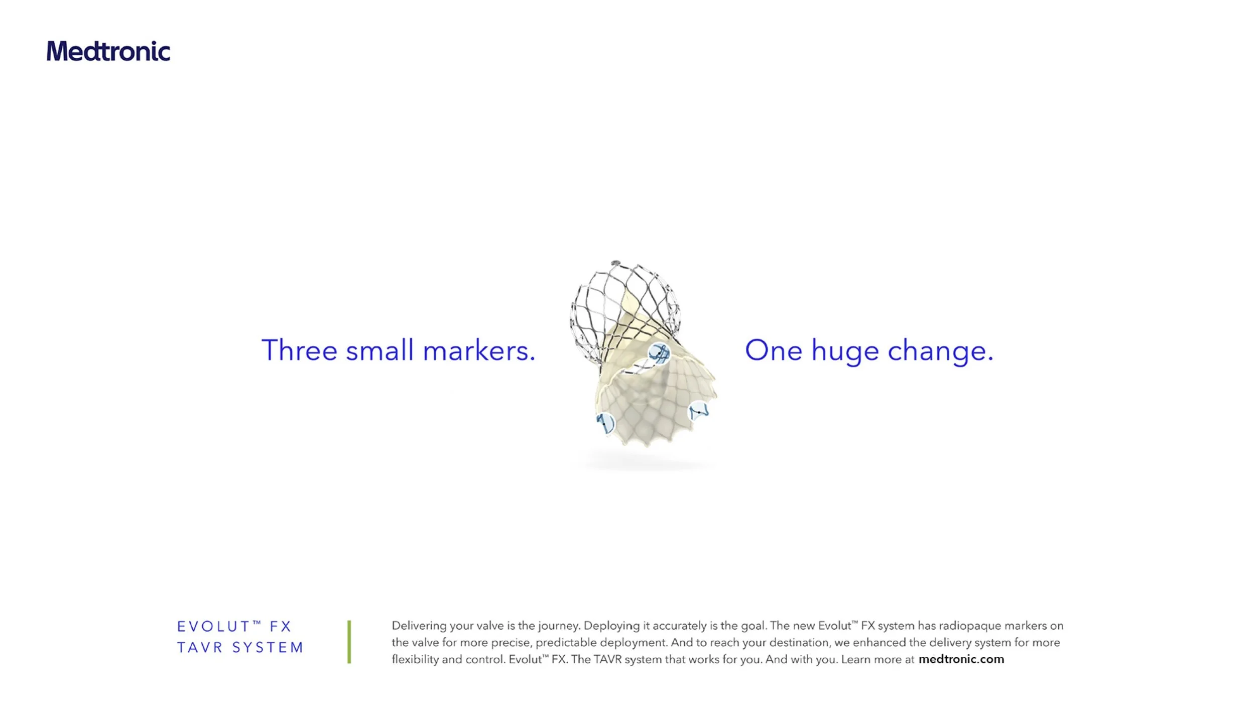 Evolut FX TAVR Small MArkers.jpg