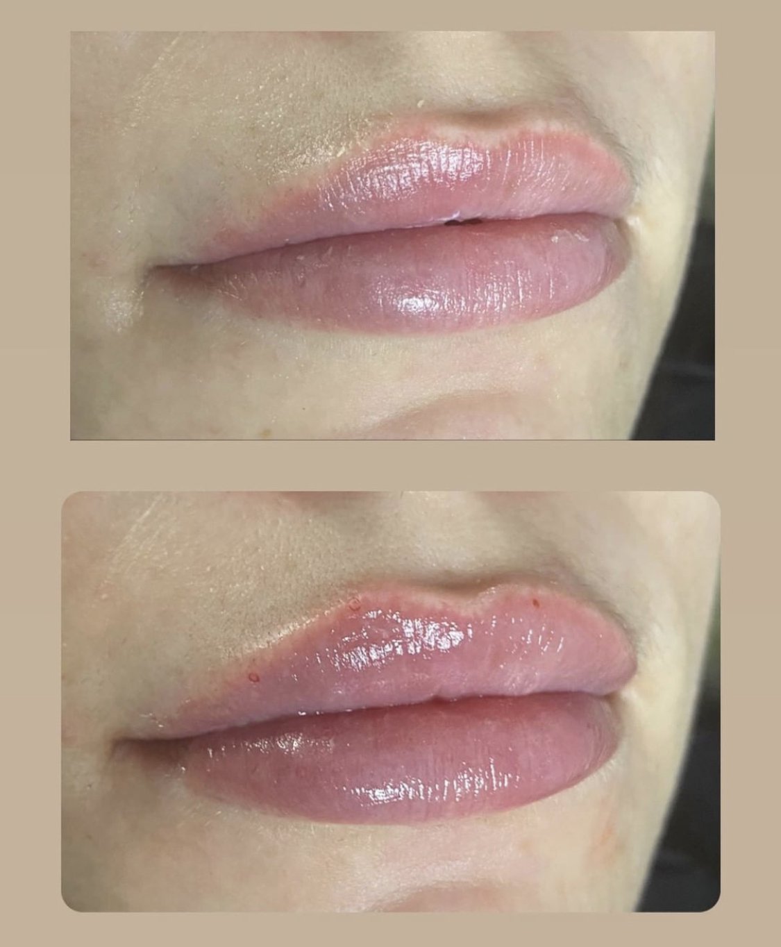 lips8.jpg