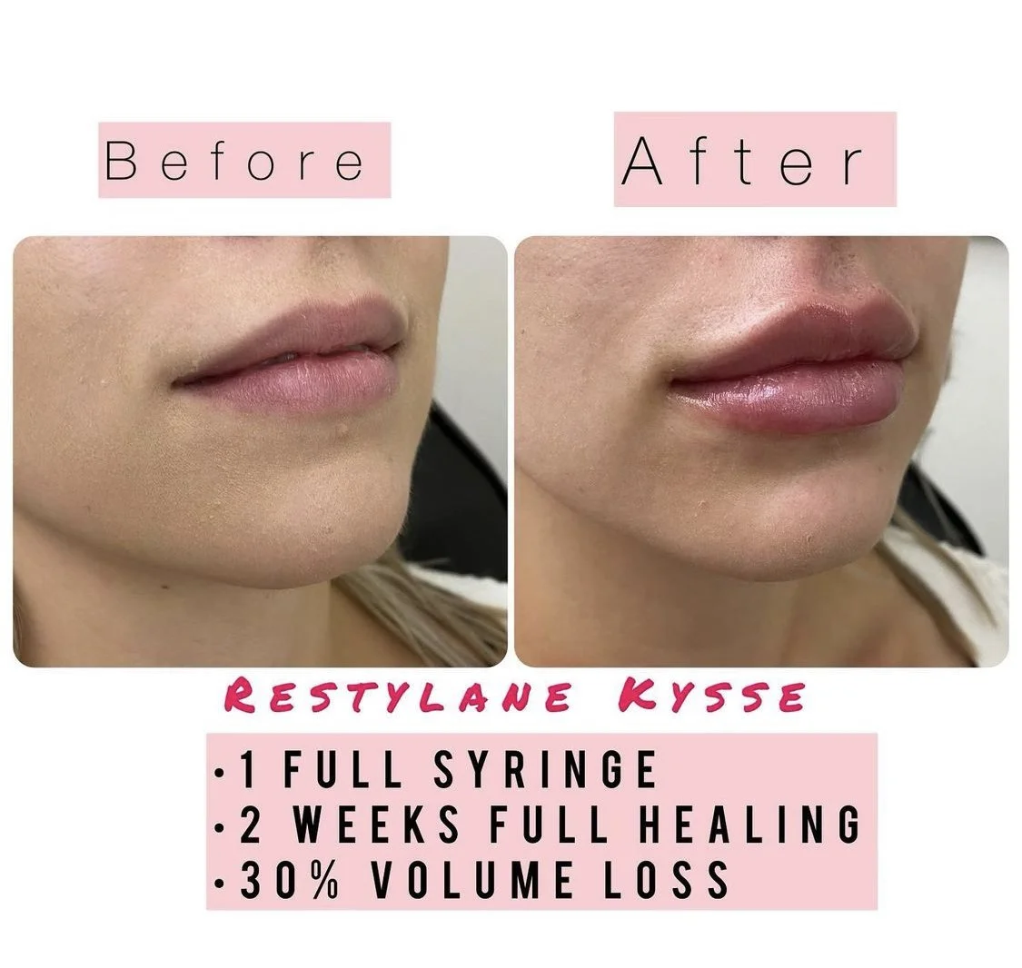 Cosmetic Injectables — Prairie Bliss