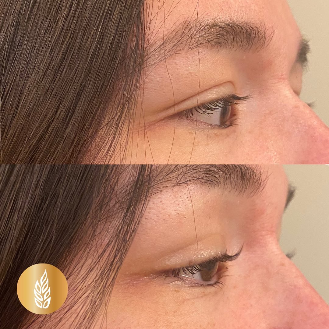 Check out these lovely Lash Lift &amp; Tint results done by our wonderful aesthetician Zeny! ✨

📞306-652-0858
💻online or through our app &ldquo;Prairie Bliss&rdquo;
📧 admin@prairieblisslaser.com