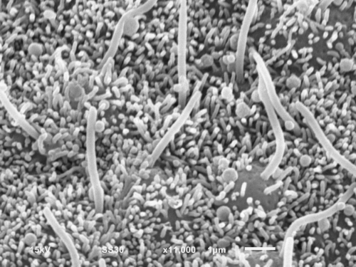 131128 lrm5 het8 x11000 15kV (1).jpg