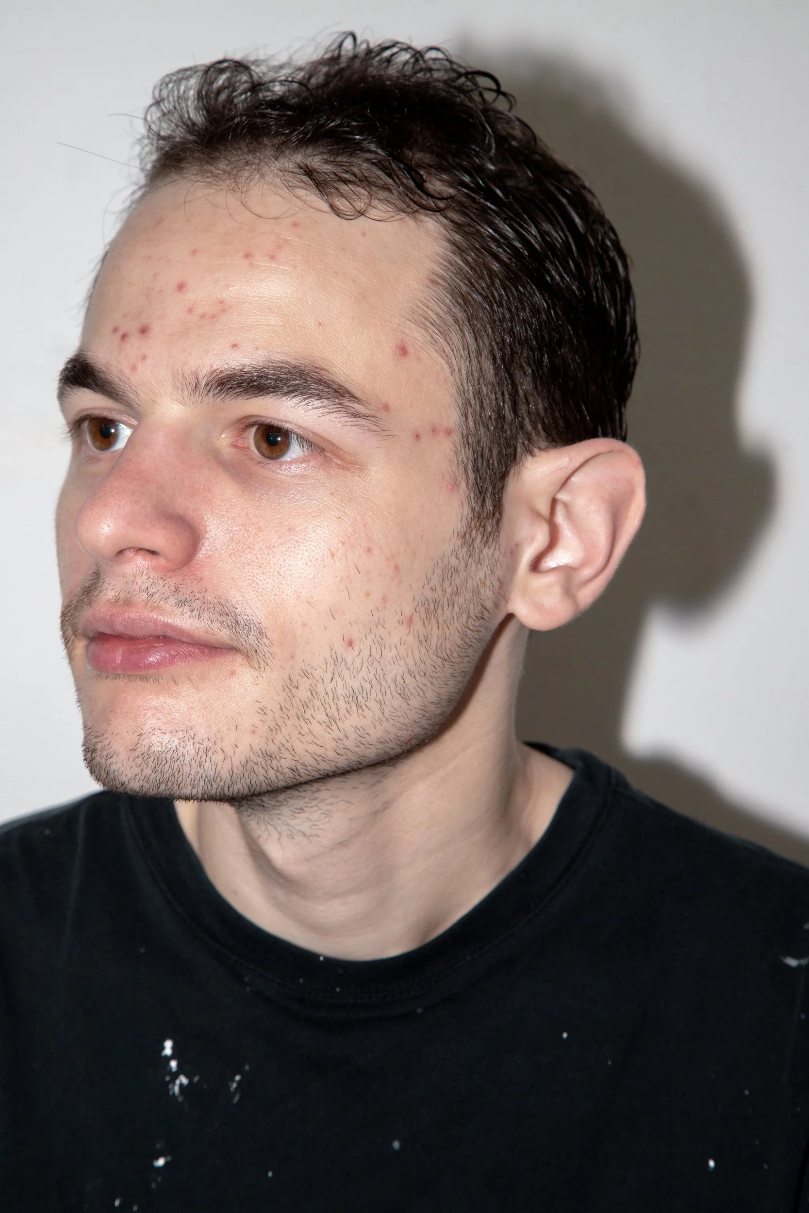 Anton, 2025