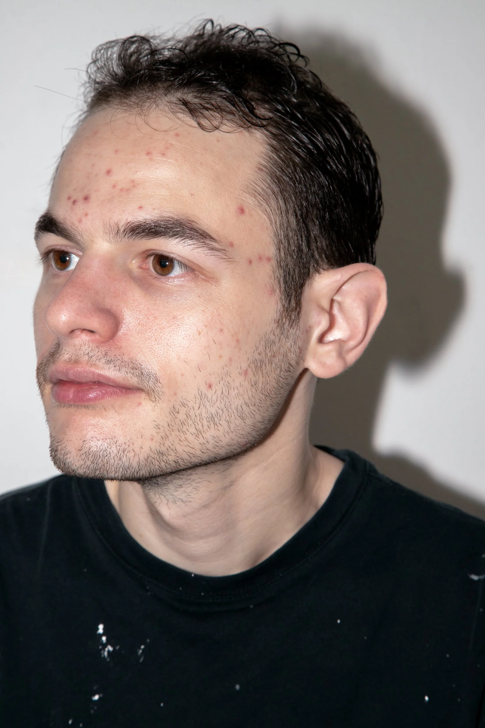 Anton, 2025