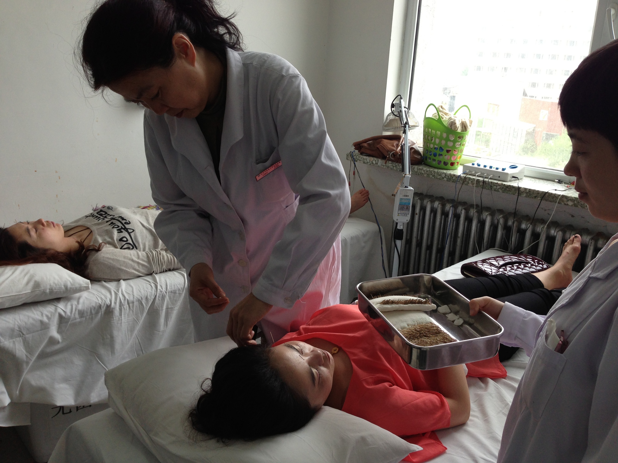 Acupuncture for emotions