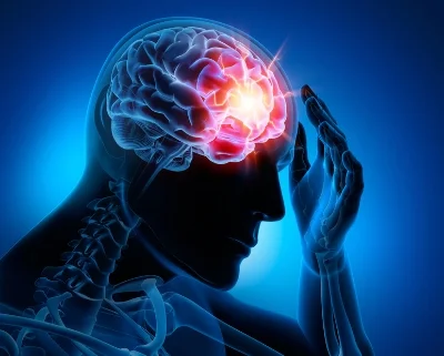 Debilitating migraine.