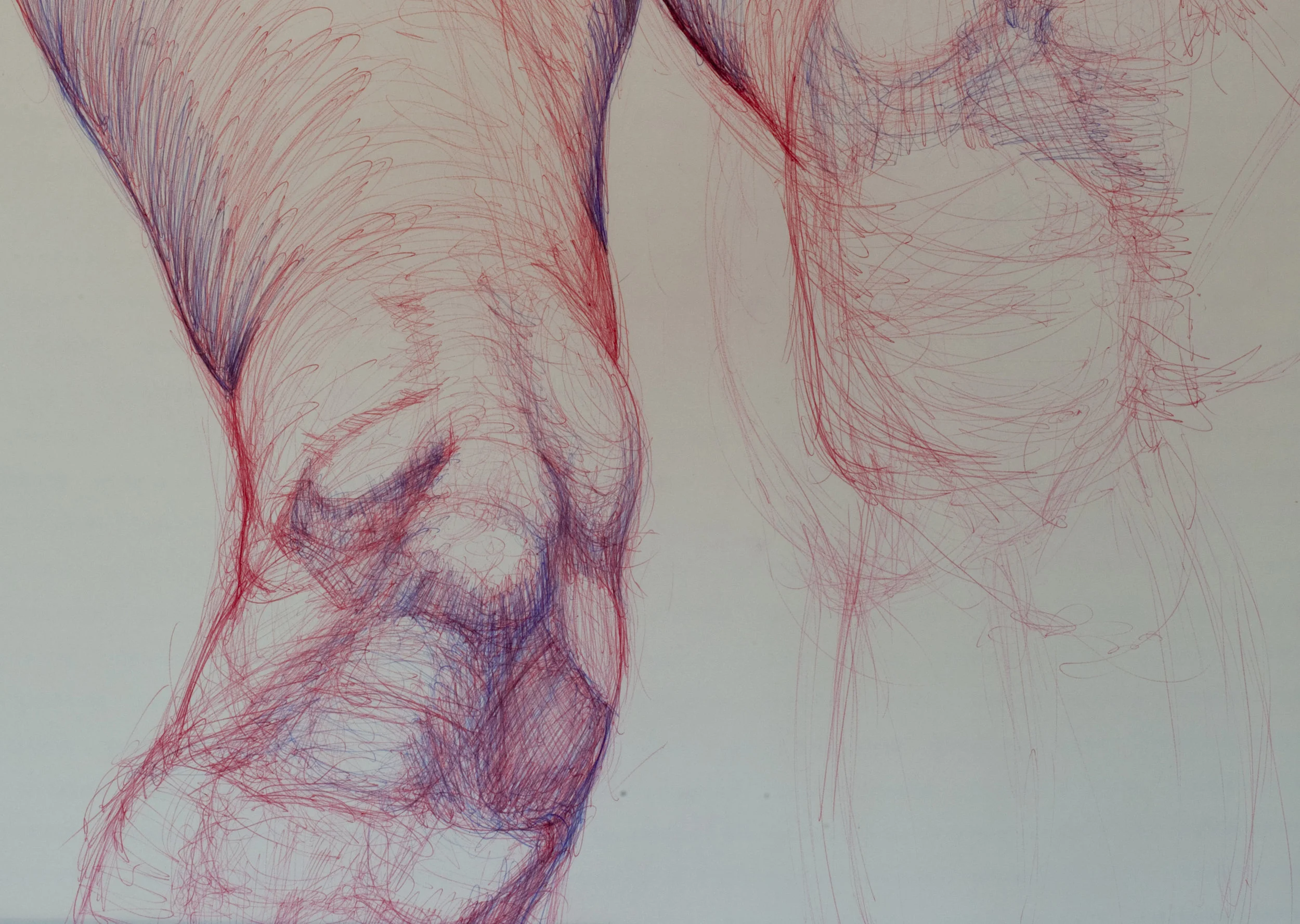 leg.jpg