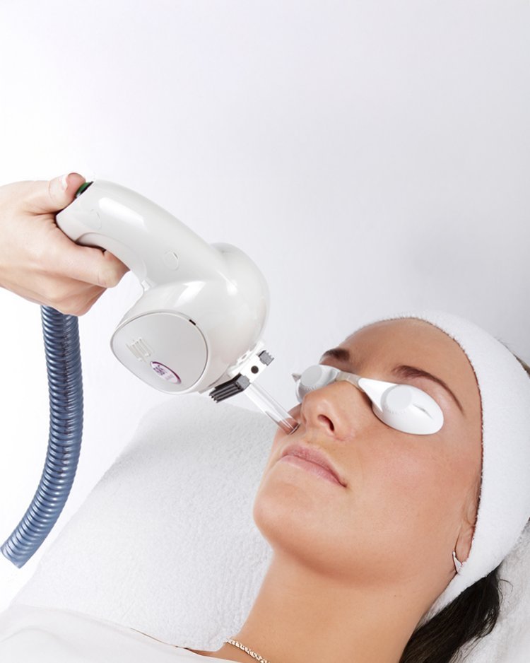 TSC+IPL+and+Laser+for+Skin+Conditions.jpg
