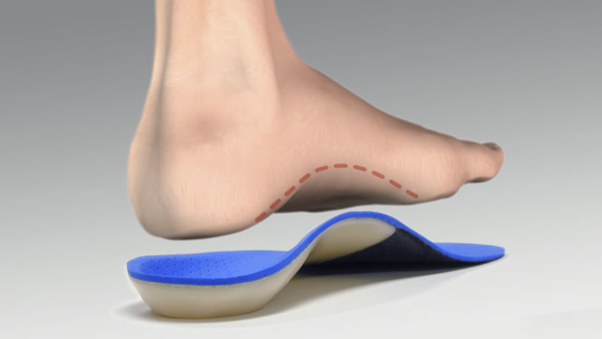 Arch Supports, Custom Orthotics