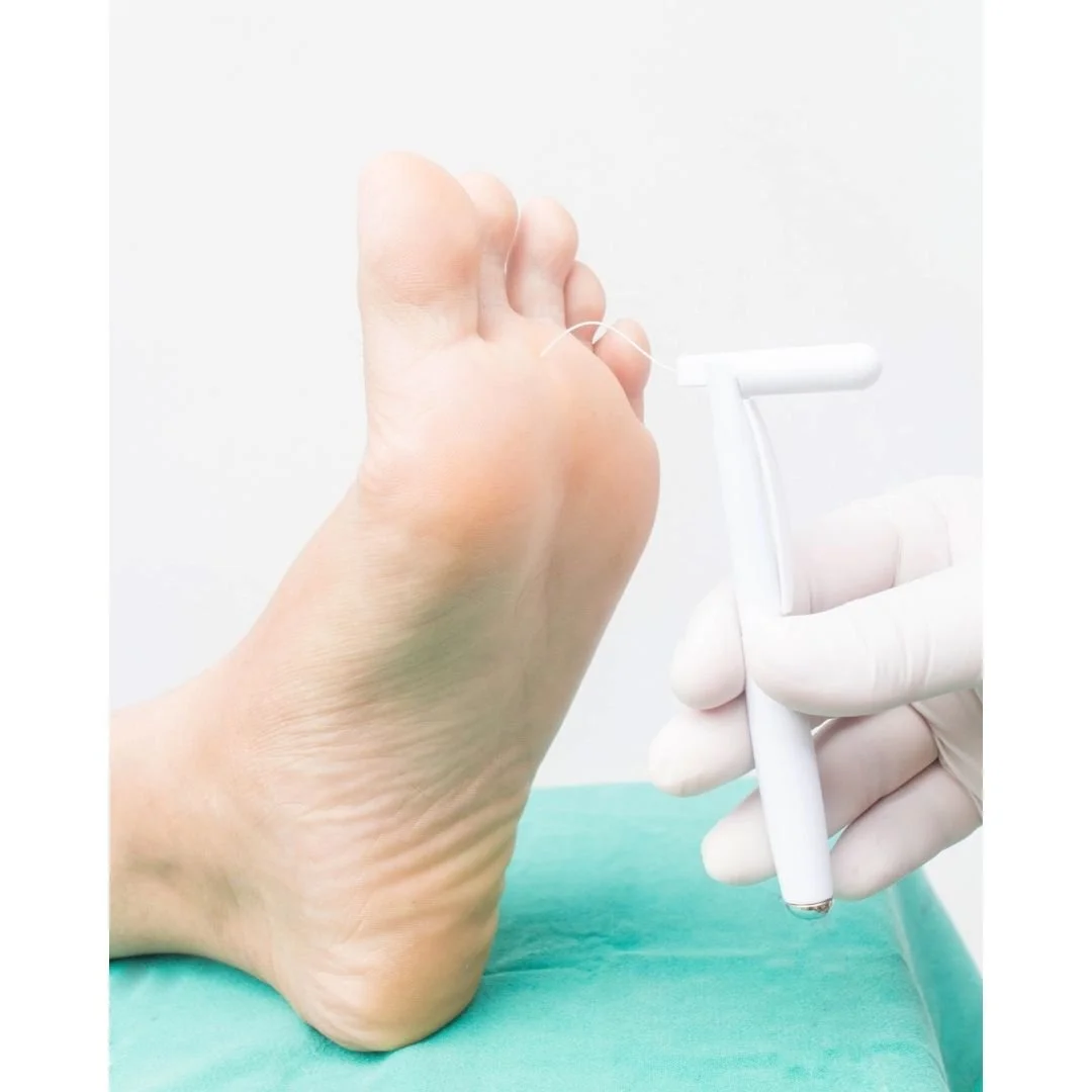 Diabetic Peripheral Neuropathy, What you should know