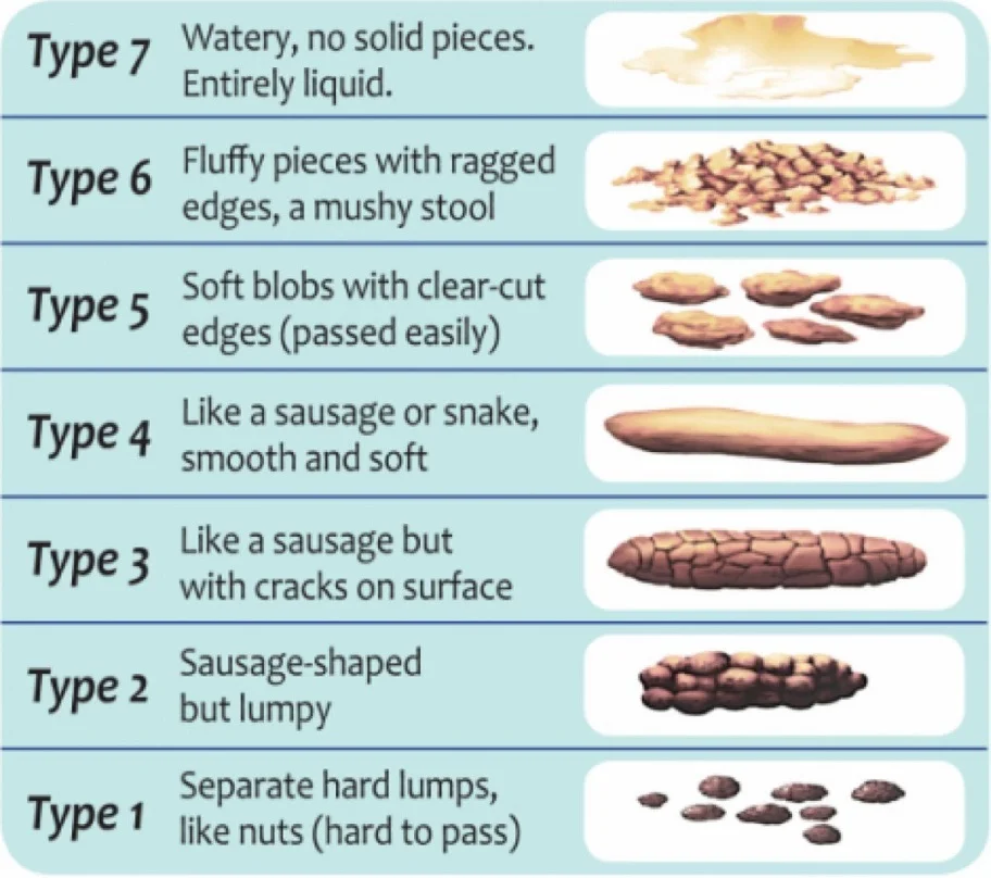 149 - 'The Bristol Stool Chart'