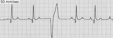 Electrocardiography (ECG) This test evaluates for heart rhythm or abnormal heart rhythm (arrhythmia). Holter Monitoring and Event Recording For animals who need further evaluation of arrhythmia, a small beeper-like device that is fitted into a harness and worn by your pet 24 hours in the comfort of your home. 