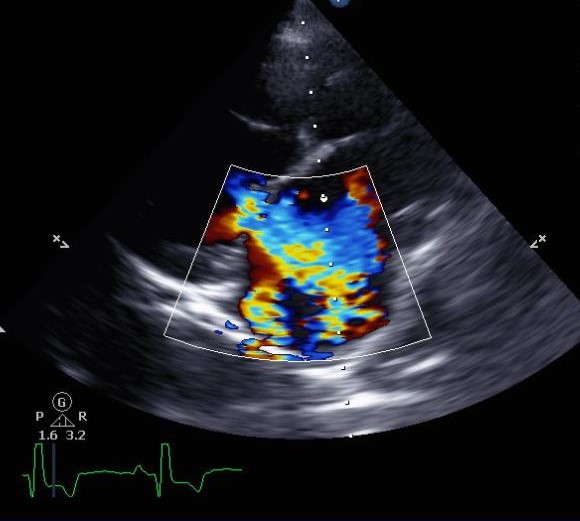 Echocardiography (Ultrasound of the Heart) Patients will receive a full echocardiogram by a board certified veterinary cardiologist. This is a non-invasive test to determine the exact type and severity of congenital or acquired heart disease present. Call 732-996-5608 or contact us here. Friendly staff will answer any questions.