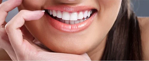 perfect-smile-compressor.jpg