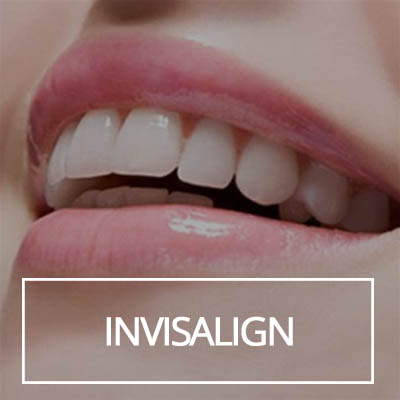 Invisalign