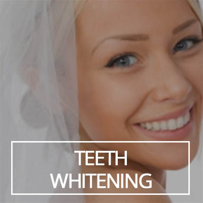 Teeth Whitening