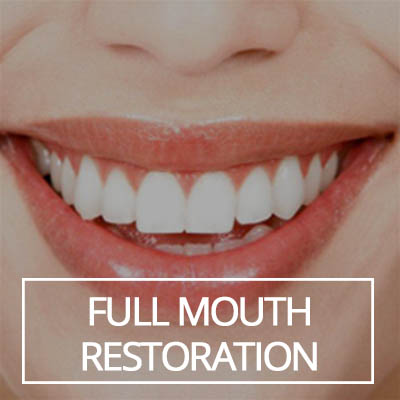 Full Mouth Restoration