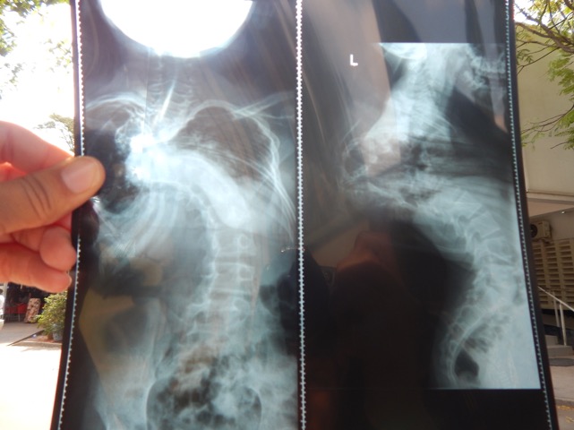 Kiliwe, Zainabu Xray Combined.jpeg