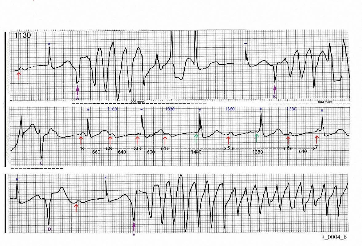 The first two strips are continuous, the third strip is taken very soon afterwards