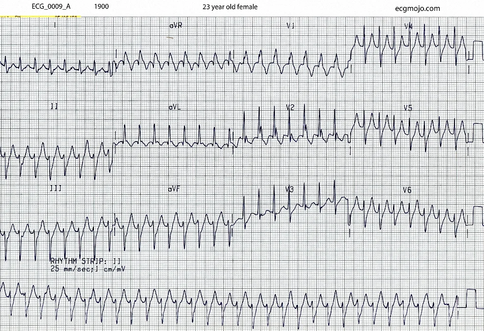 ECG_0009_A taken at 1900