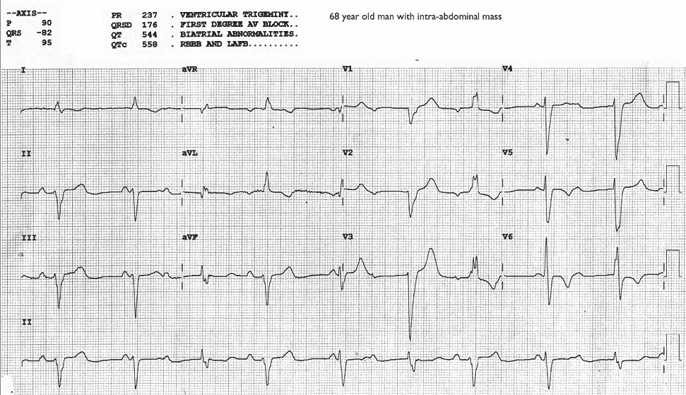 Figure 2. ECG of Case C_0002