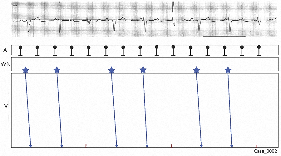Figure 10. Laddergram 6