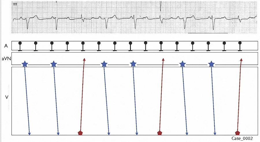 Figure 11. Laddergram 7