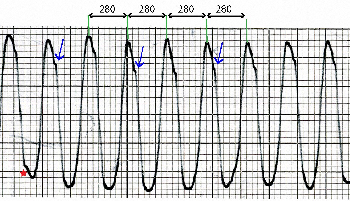 Figure_2. MagnifiedpartofR_0005