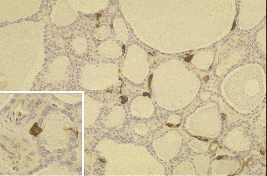 Figure_2. The parafollicular cells are stained brown