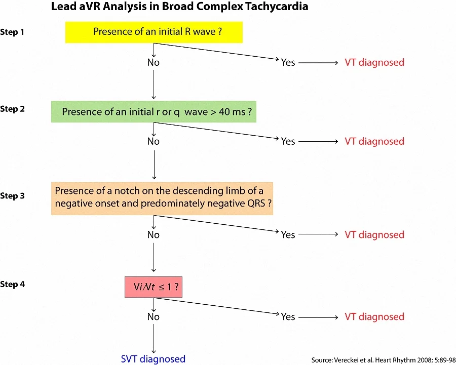 Figure 2. Algorithm that uses only Lead aVR to determine the likely mechanism in wide QRS complex tachycardia