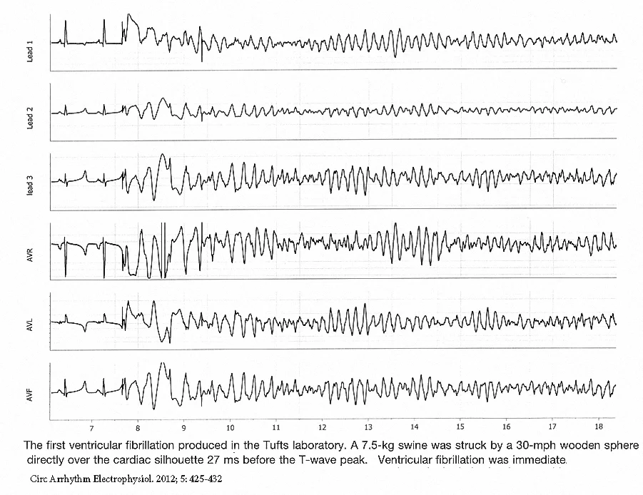 Figure 10. Experimental commotio cordis