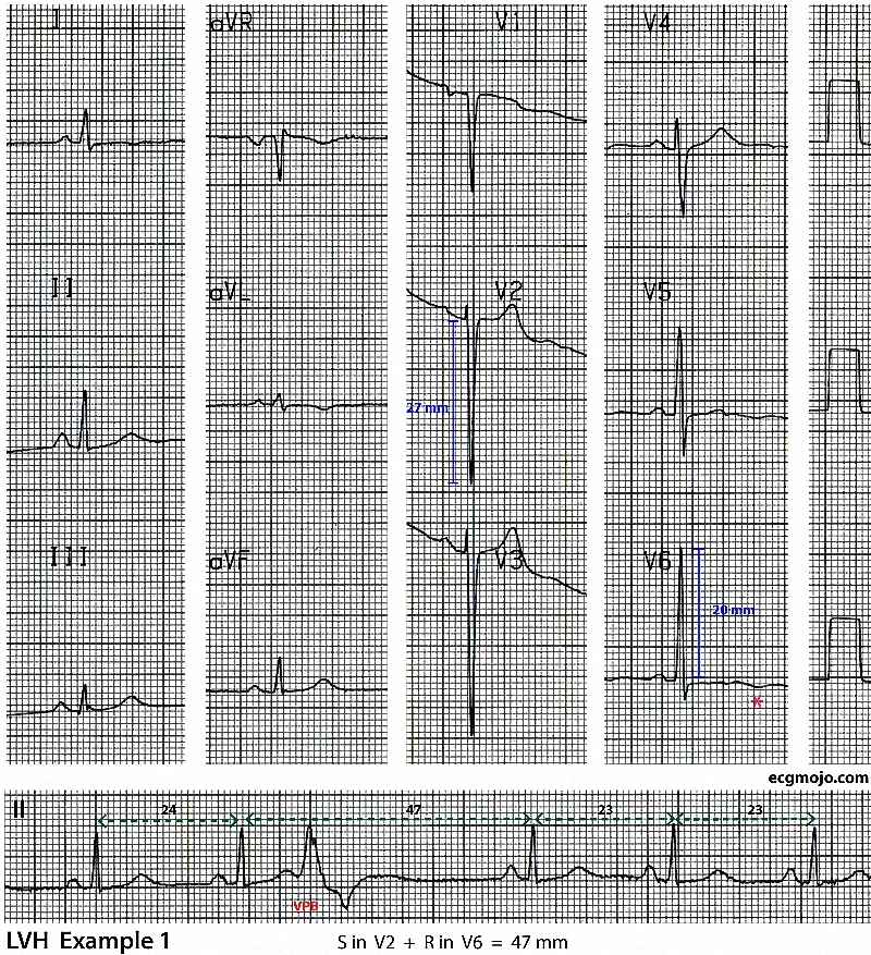 Figure 5 - Example 1