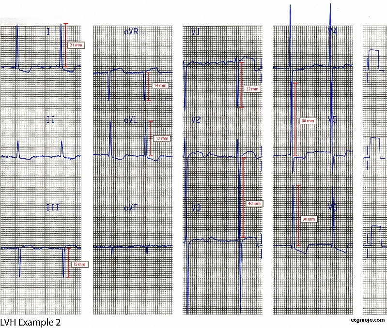 Figure 6 - Example 2