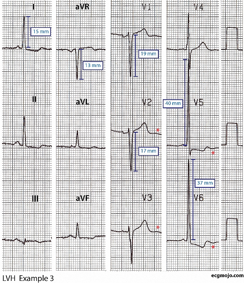 Figure 7 - Example 3