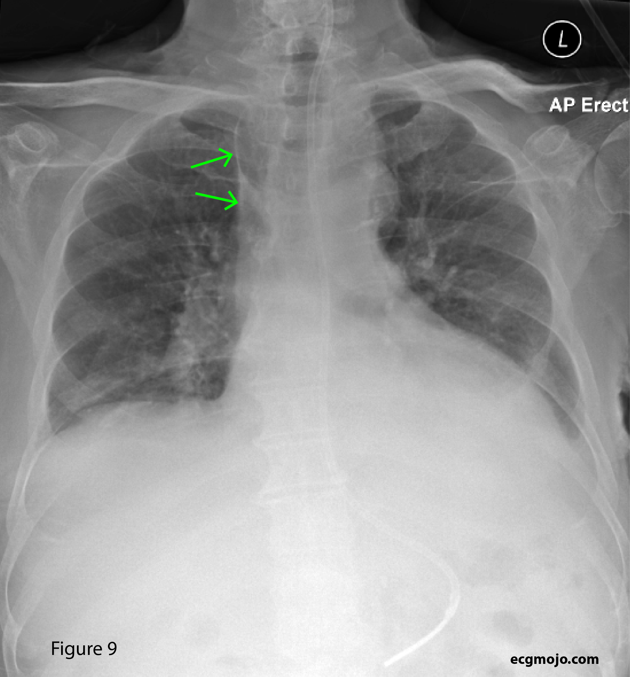 Figure 9