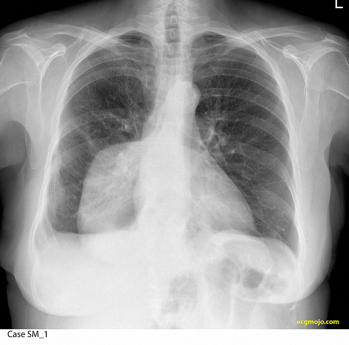 Figure 11