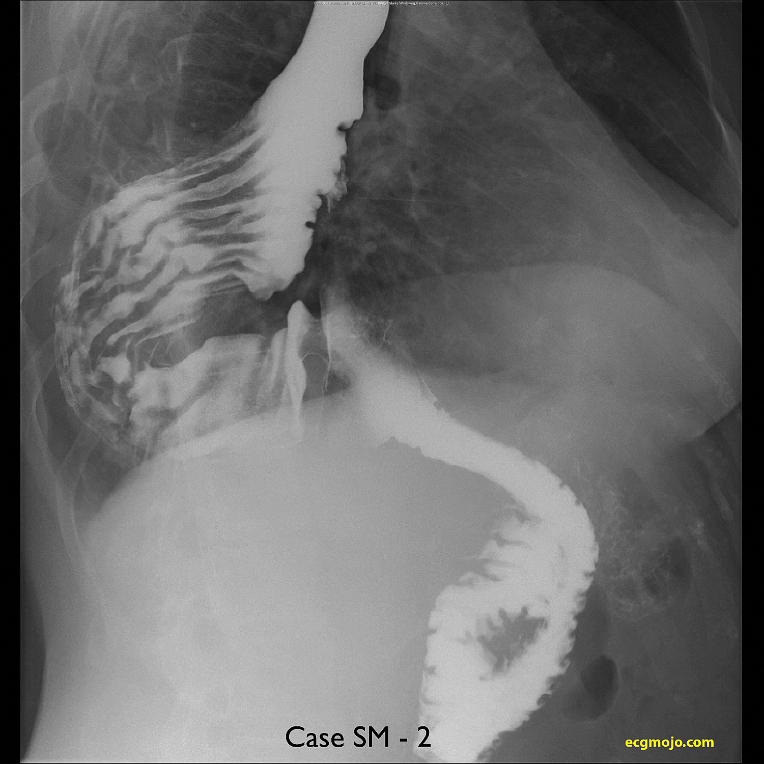 Figure 12
