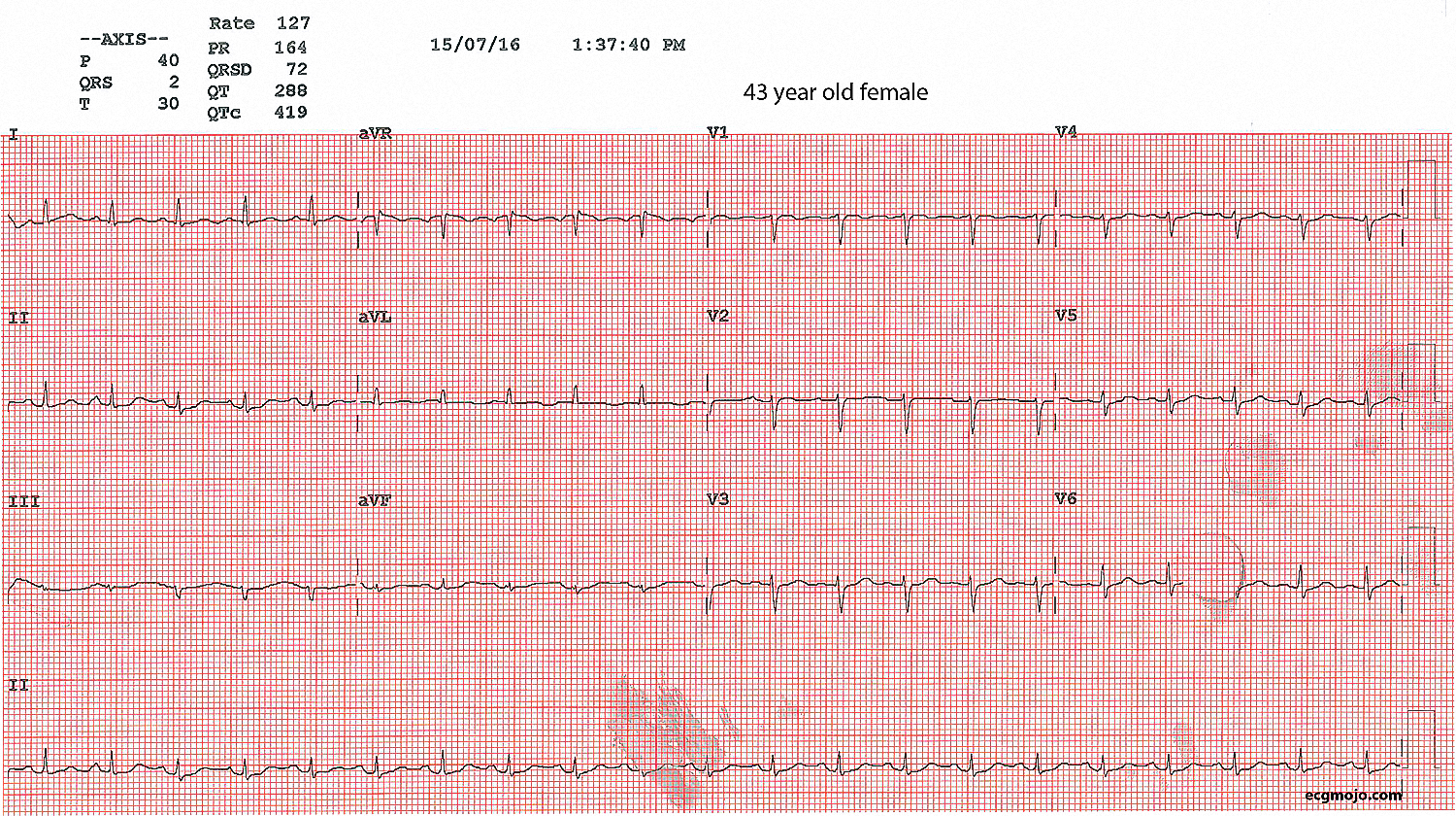 Figure 17