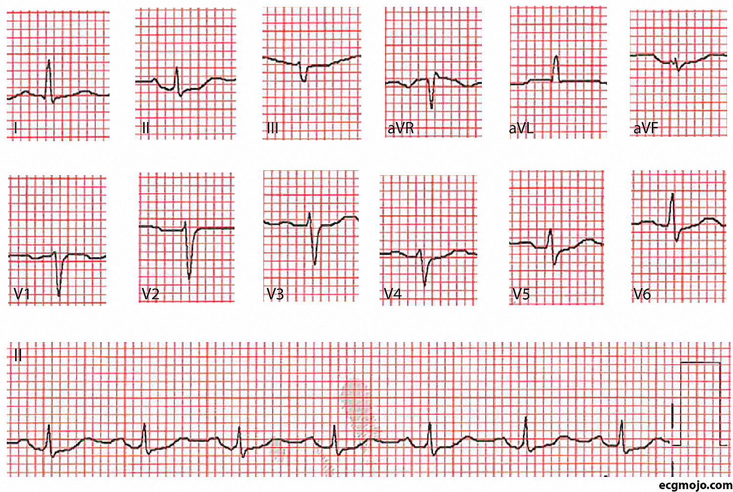 Figure 18