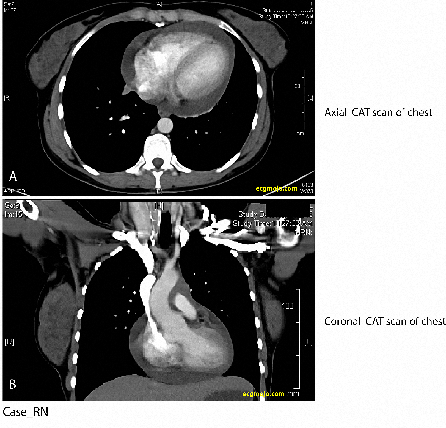 Figure 19