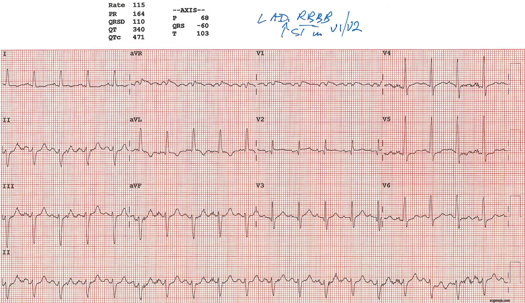 Figure 4 
