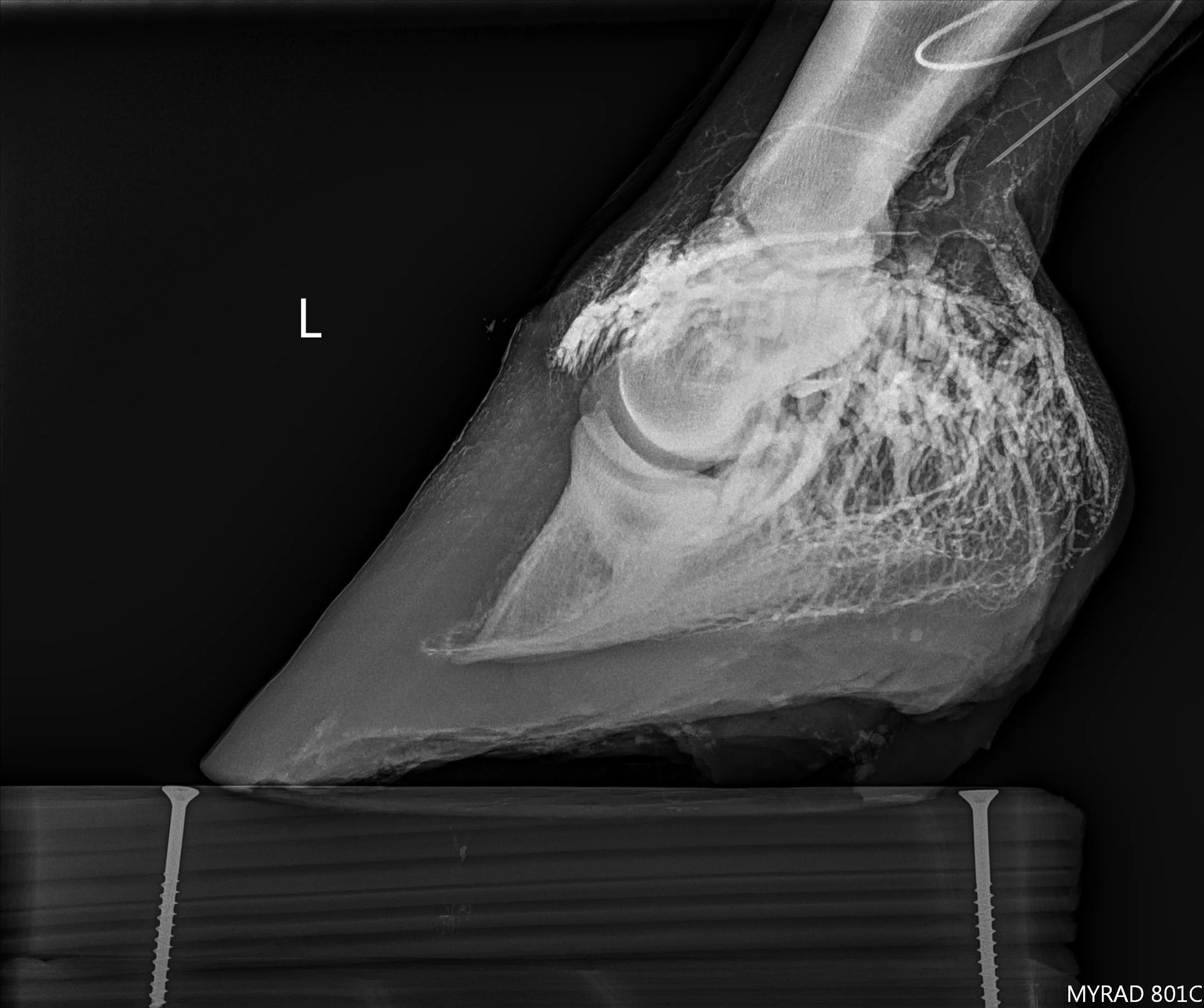 Venogram (1).jpg