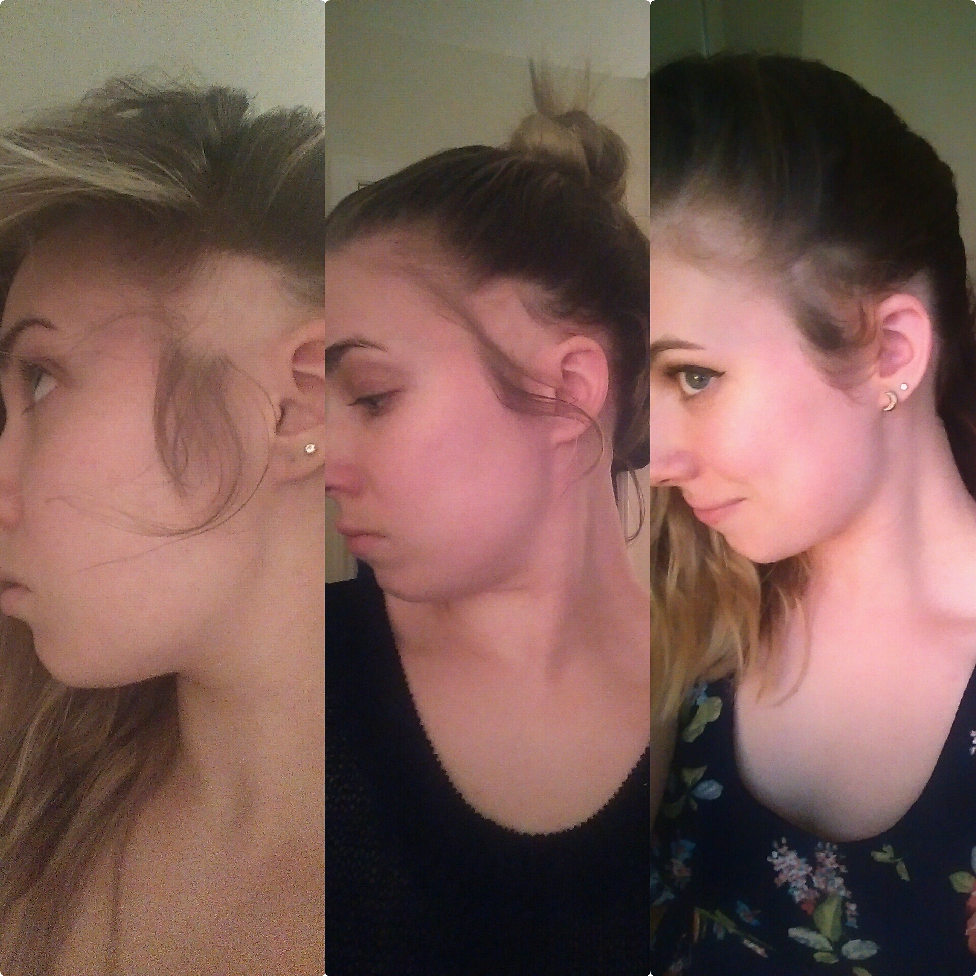 Hair growing back in!!