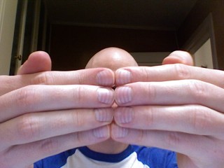 Chemo Fingernails.jpg