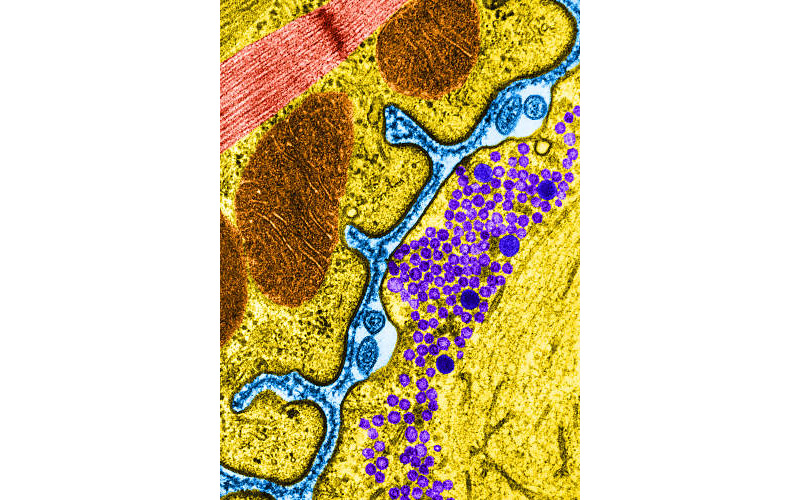 Transmission Electron Micrograph (TEM)