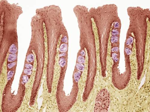 Light Micrograph (LM)