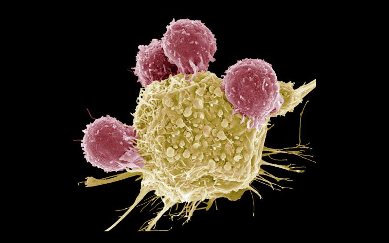 Micrographs, T-lymphocytes
