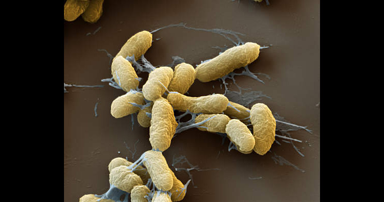 Plague (Yersinia pestis) Bacteria